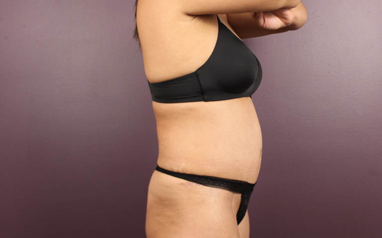 1_0031_RDtum (10).png