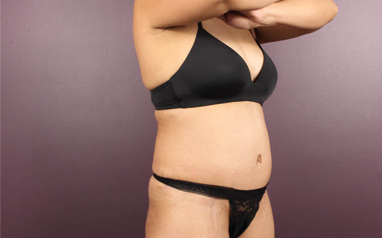 1_0033_RDtum (12).png